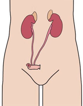 scheme of urostomy