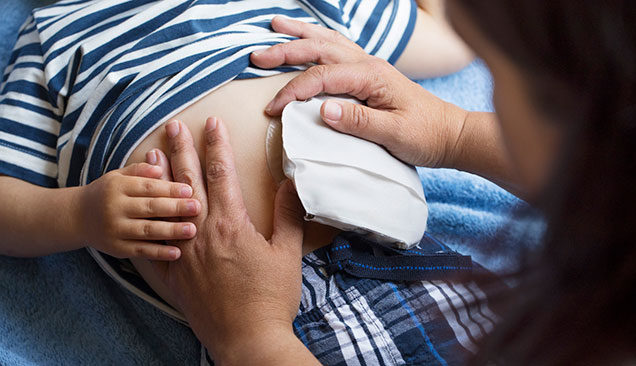 applicare la sacca per stomia a un bambino