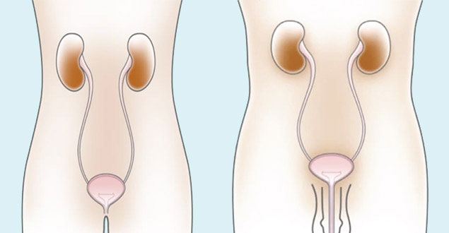 men and women - urinary system