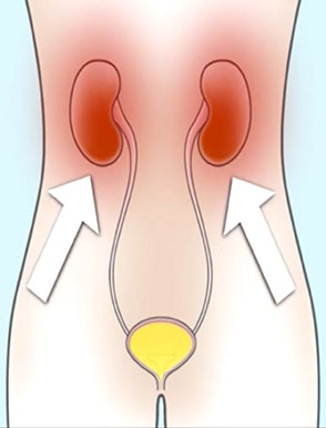 How often should I empty my bladder?